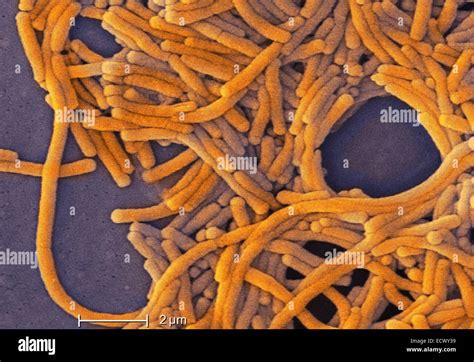 Scanning Electron Micrograph Of Legionella Bacteria Stock Photo Alamy