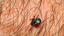 Rocky Mountain spotted fever: the deadliest tick-borne disease - CNN