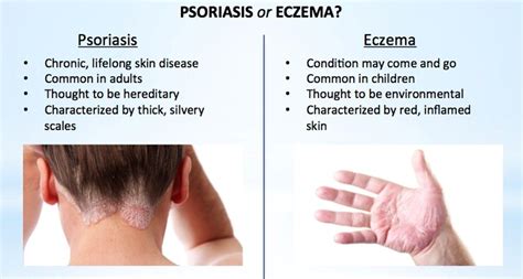Psoriasis Hashtag On Twitter Psoriasis Eczema Eczema Cure
