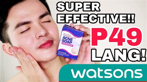 Dermaid Acne Soap Sa Watsons Super Effective For Pimples Youtube