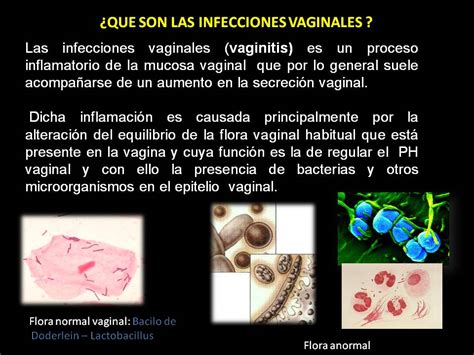 Salud Para La Mujer Y El Hombre Infecciones Vaginales Que Son Y Como Prevenirlos