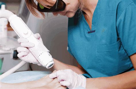 Laser Toenail Fungus Removal Foot Doctor Marietta And Atlanta Ga