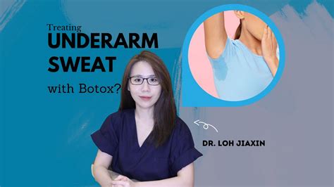 Severe Underarm Sweating Axillary Hyperhidrosis Treated With