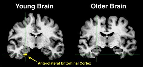 Young Brain Vs Older Brain Image Eurekalert Science News Releases