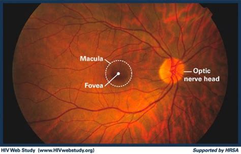 Ocular Anatomy The Fundus Image Of The Retina Anatomy Of The Eye