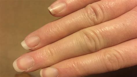 Fingernails And Health Signs 10 Signs That Could Be Woc Print