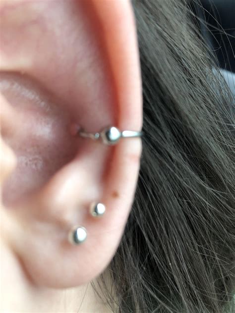 Bumps Around Ear Piercings Causes And Treatments Sweetandspark