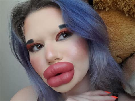 Bulgarian Woman With Biggest Lips In The World To Inject Lips For