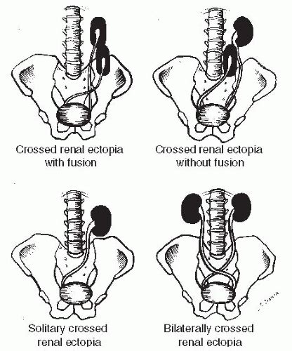 Congenital Anomalies Radiology Key