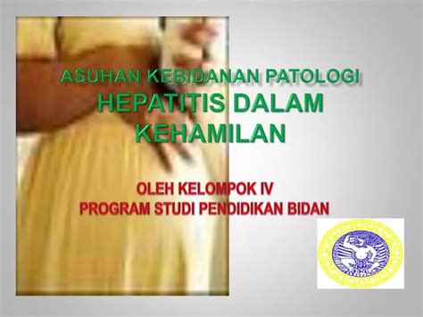 Ppt Asuhan Kebidanan Patologi Hepatitis Dalam Kehamilan Powerpoint