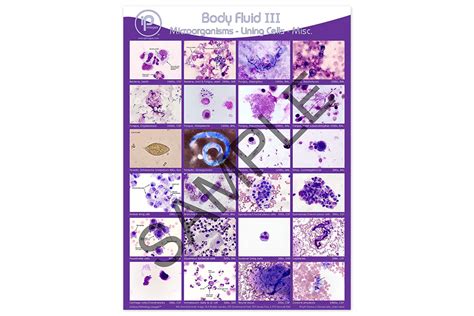 Body Fluid Iii Microorganisms Lining Cells Misc