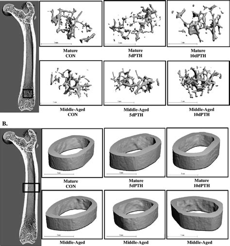 Representative μct Images Of A Trabecular Bone Microarchitecture And