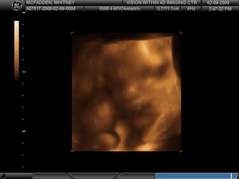 3d Ultrasound 33 Weeks Robertmcfadden Flickr