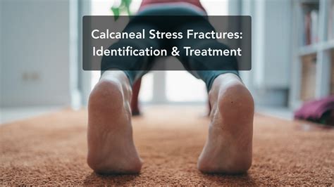 Calcaneal Stress Fractures Identification And Therapy Health Circulate
