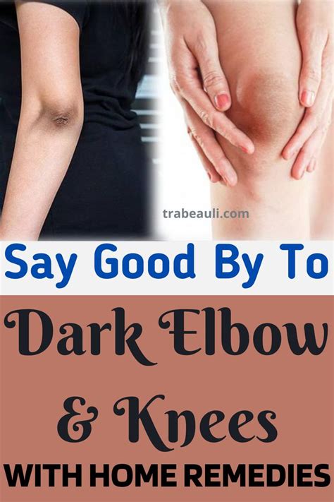 How To Get Rid Of Dark Elbows Overnight At Home Trabeauli Dark