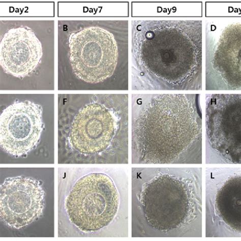 Development Of Preantral Follicles During In Vitro Culture Typical