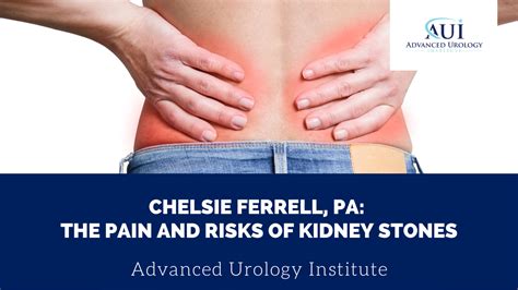 Chelsie Ferrell Pa The Pain And Risks Of Kidney Stones Advanced