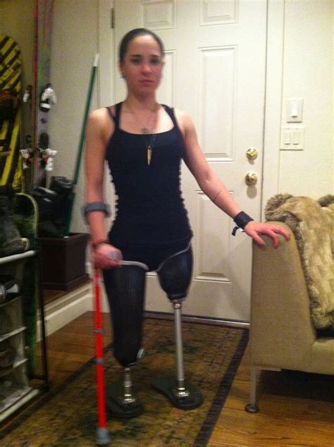 20 Things Prosthetic Leg Users Want You To Know Prosthetic Leg Prosthetics Amputee Lady