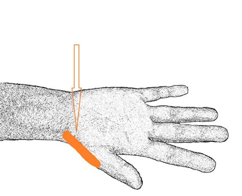 Apa itu titik refleksi tangan? BALI NDESO MBANGUN DESO: REFLEKSI KESEHATAN