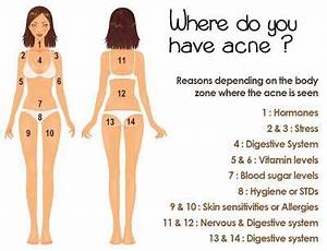 The Location Of Body Acne Can Explain The Real Reason Why
