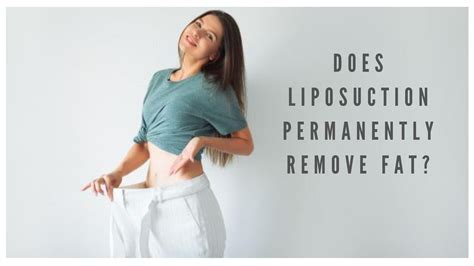 Does Liposuction Permanently Remove Fat? | Dr. V. S. Rathore