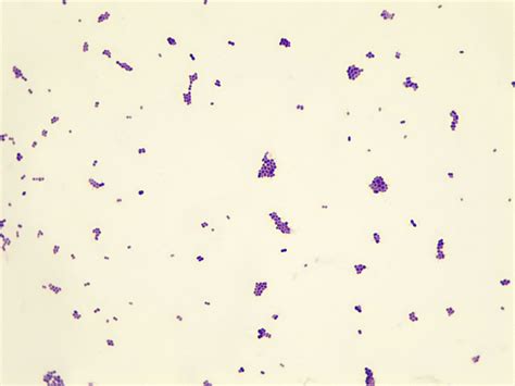 Micrograph Staphylococcus Aureus Gram Stain 1000x P000029 OER Commons