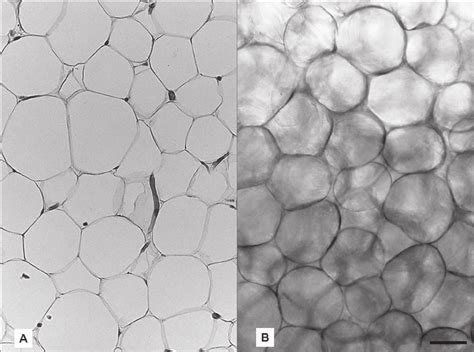 Light Microscopy Of Human White Adipose Tissue A Subcutaneous