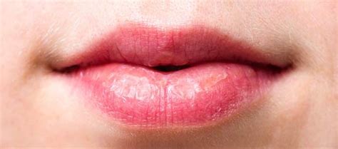 Itchy Lips Symptoms Causes Treatment And Prevention