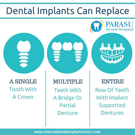 Dental Implants Cost In Chennaiindia Treatment Option For Dental