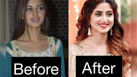 Top 10 Plastic Surgery Photos Of Pakistani Tv Actress