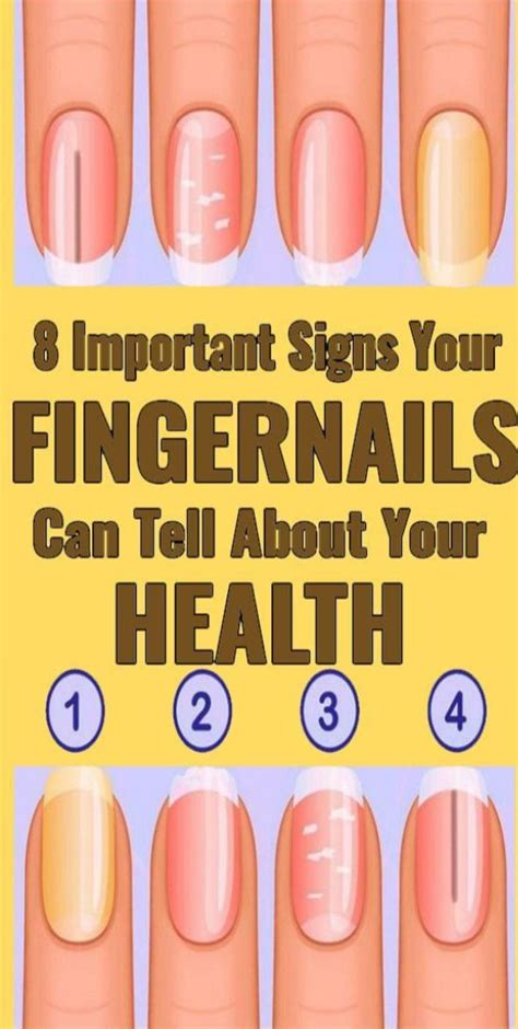 8 Important Signs Your Fingernails Can Tell About Your Health Lines