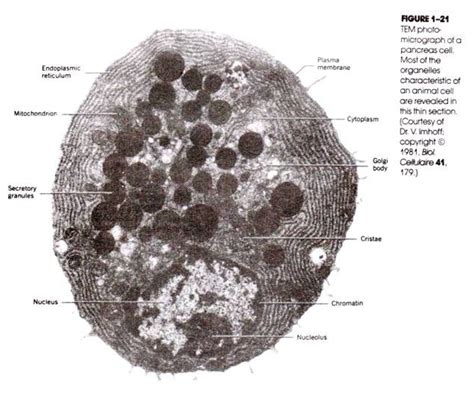 Eukaryotic cells, mitochondria, plant cell vs. Animal cell, Organelles, Sauna design