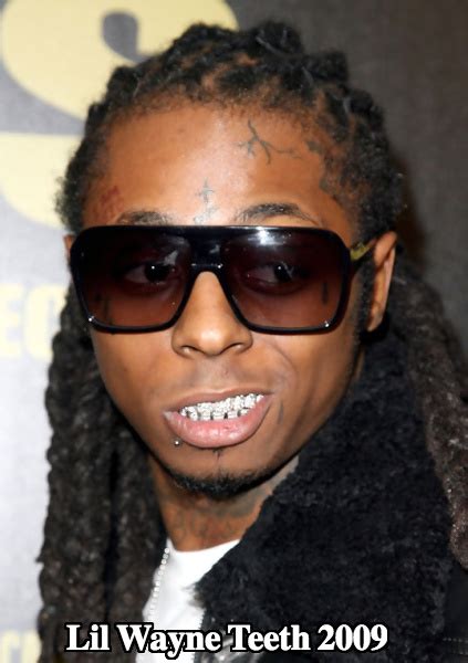 Despite wide speculation that lil wayne's teeth are cosmetic items, lil wayne made statements to suggest that his diamond teeth are permanent. Lil Wayne Teeth - Diamonds Make His Words Precious ...