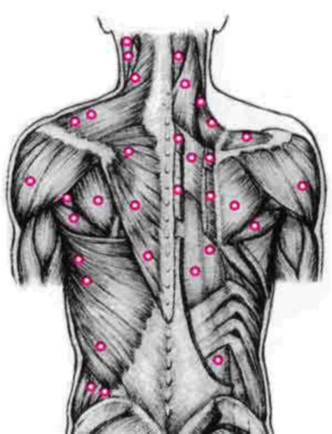 Effective Trigger Point Therapy For Muscle Knots Massage Therapy