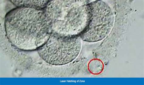 Hazrat E Maryam Fertility Center Services In Vitro Embryo Hatching