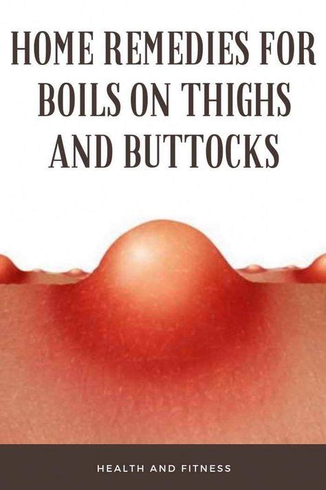Home Remedies For Boils On Thighs And Buttocks Teenagersskincare With