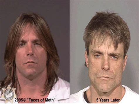 Photos How Methamphetamine Destroys Your Face And Physical Appearance