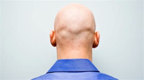 Hair Loss No More Researchers Make ‘critical Breakthrough With
