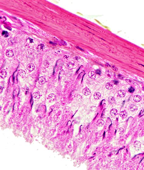 4 35 Tecido Conjuntivo Histologia