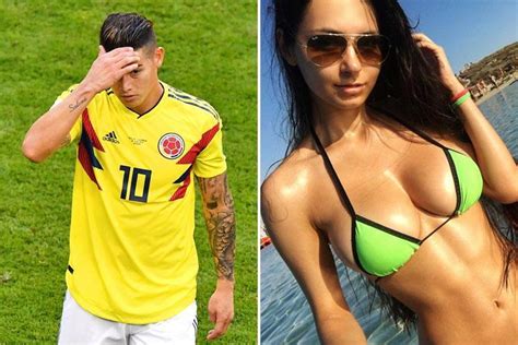 James Rodriguez Mocked Over Model Wag As He Limps Off Against Senegal