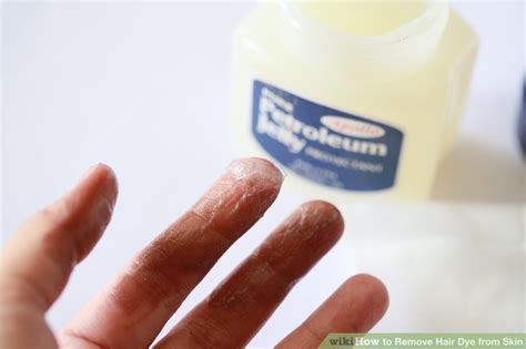How to prepare the solution: 6 Ways to Remove Hair Dye from Skin - wikiHow