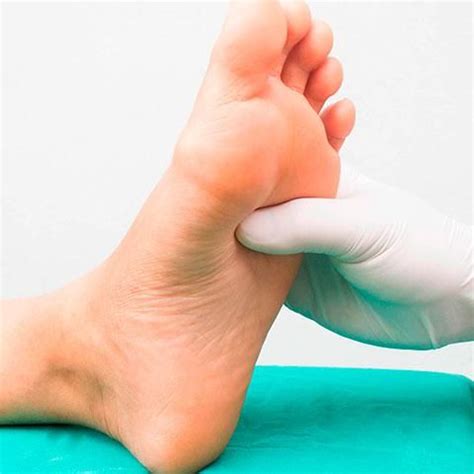 10 consejos para prevenir y cuidar un pie diabético Heal Bruises Feet