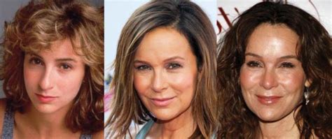 Jennifer Grey Plastic Surgery Before And After Pictures