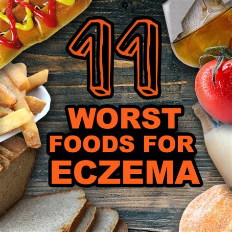 Foods To Avoid With Eczema Top Eczema Treatments