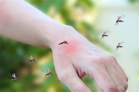 Mosquitoes Bite On Adult Hand Made Skin Rash And Allergy With Red Spot