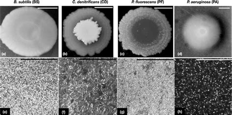 Figure Shows The Macroscopic And Microscopic Pictures Of Biofilms A D