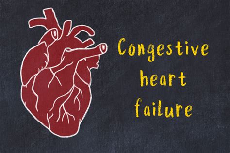Congestive Heart Failure Symptoms And Treatment Pulse Cardiology