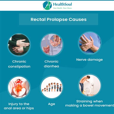 What Is Rectal Prolapse Causes Symptoms Treatment Surgery Prognosis