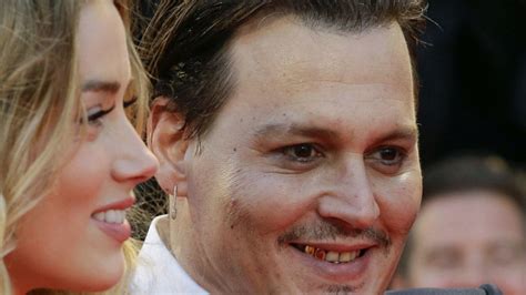 Amber Heard To Divorce Johnny Depps Teeth Flawlessvision