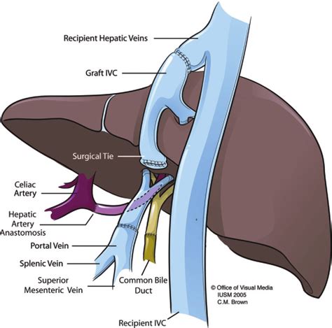 Ivc Liver Anatomy